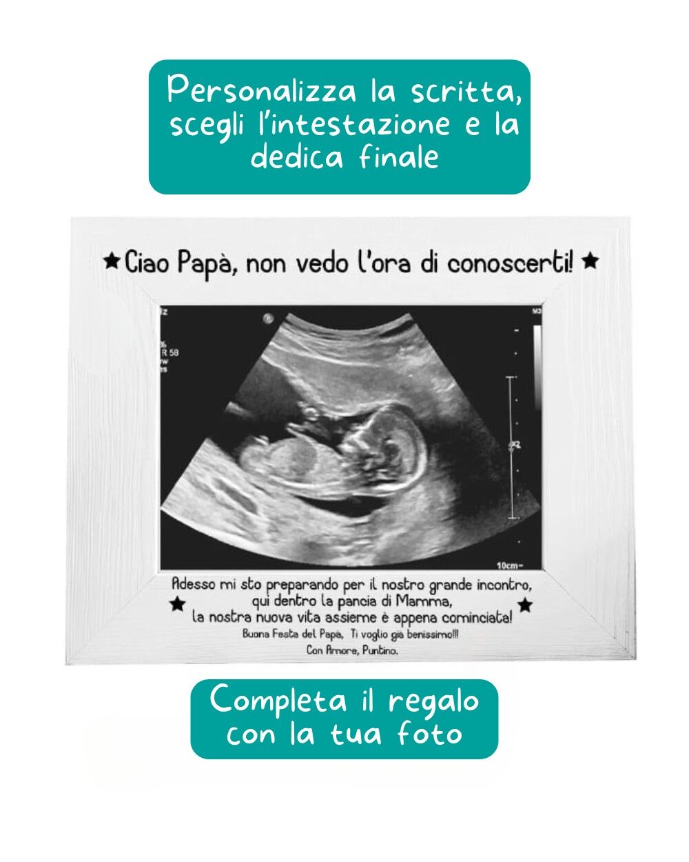 cornice-ecografia-personalizzazione